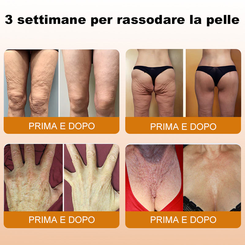 Bee Venom Peptide Cream – 3X More Effective, Firmer Skin, Fewer Wrinkles& Sagging