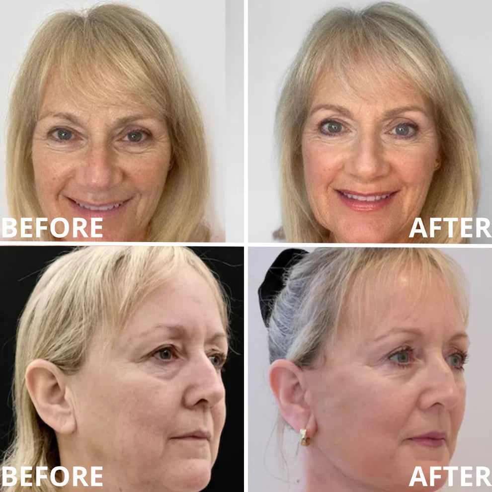 ✨ Calcium Multi Balm | Anti-Aging, Firming & Wrinkle Care