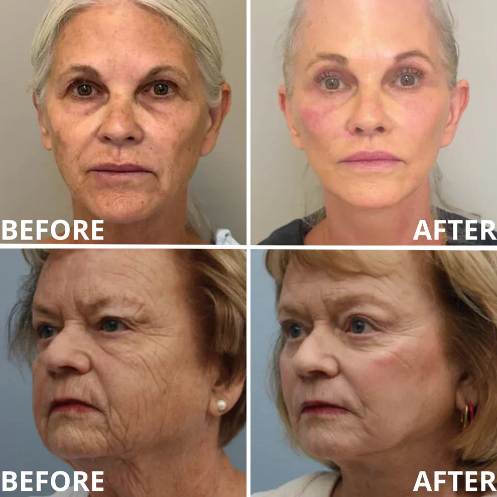 ✨ Calcium Multi Balm | Anti-Aging, Firming & Wrinkle Care