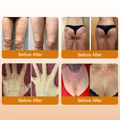 👑Bee Venom Peptide Cream – The Royal Secret to Ageless, Firmer & Visibly Lifted Skin