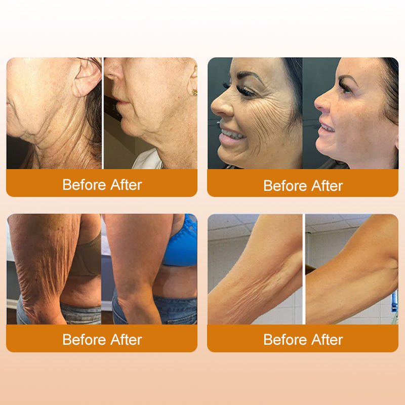 👑Bee Venom Peptide Cream – The Royal Secret to Ageless, Firmer & Visibly Lifted Skin