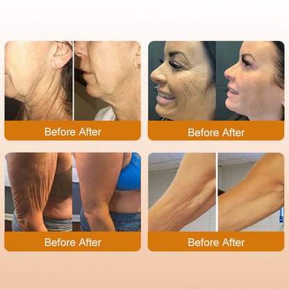 👑Bee Venom Peptide Cream – The Royal Secret to Ageless, Firmer & Visibly Lifted Skin